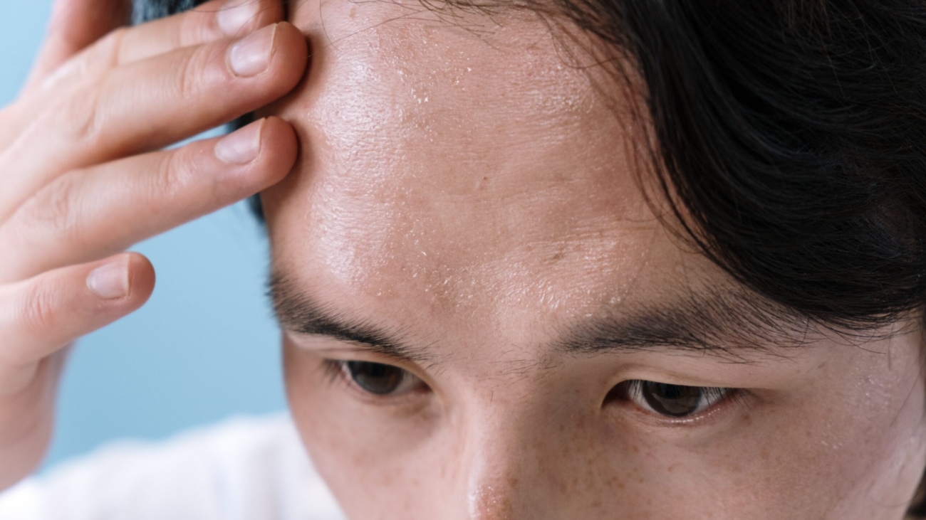 Cropped photo showing only eyes and forehead and a little bit of black hair, a man touches his sweaty forehead.