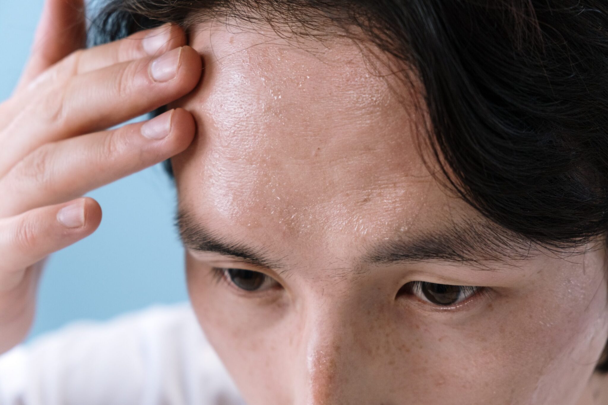 Cropped photo showing only eyes and forehead and a little bit of black hair, a man touches his sweaty forehead.